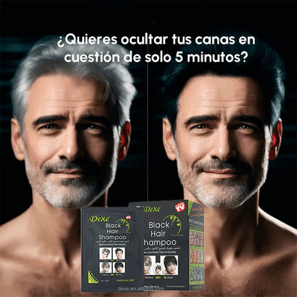 ¡REVOLUCIÓN SHAMPOO ANTI-CANAS! El Secreto IVSI® que Elimina 10 Años de tu Apariencia en 5 Minutos.
