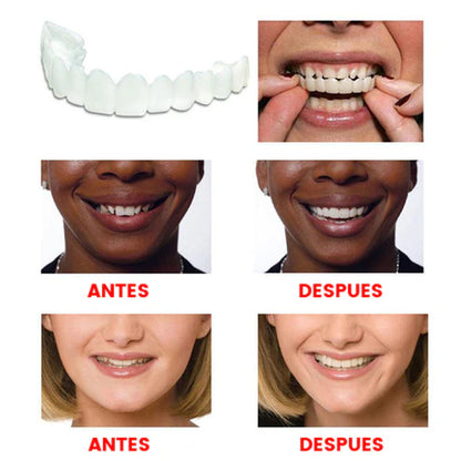 Sonrisa Pro® - Carillas Dentales Removibles (Superior + Inferior)