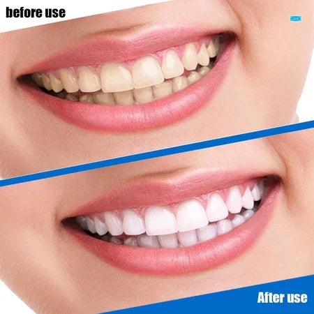 WHITEWAVE 3D™ BANDAS DE BLANQUEAMIENTO DENTAL